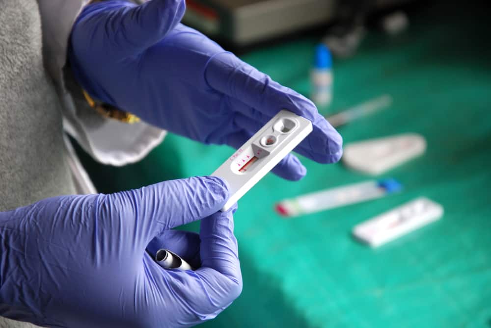 Is HIV AB rapid test accurate?