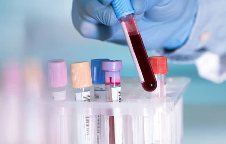 should know about blood test